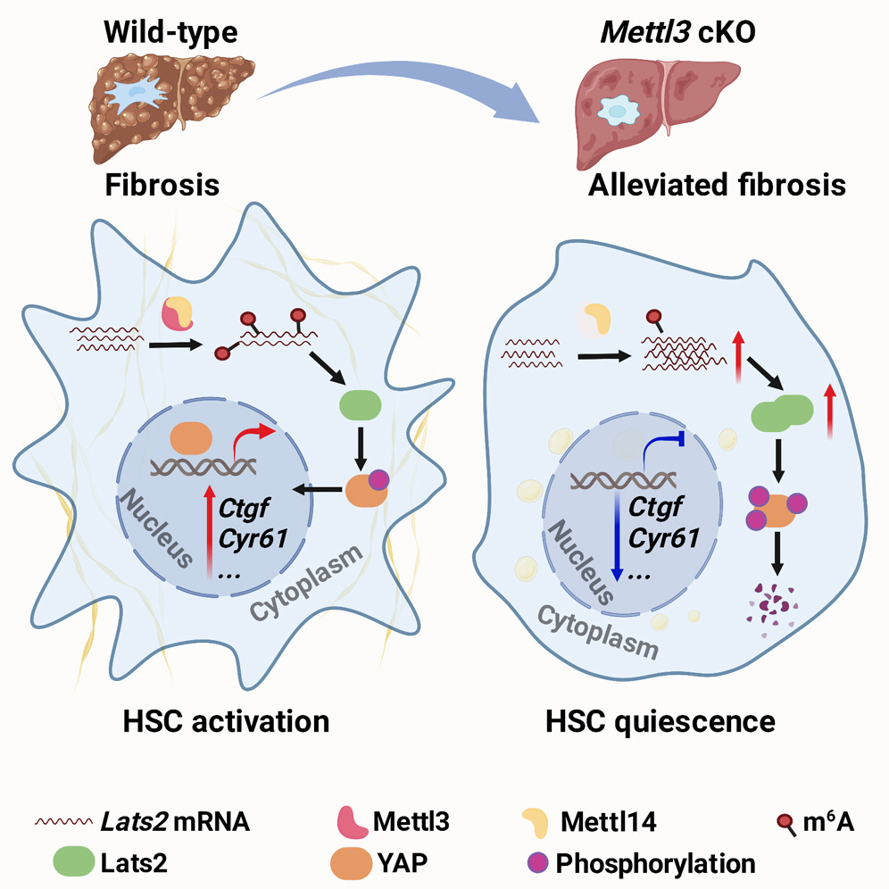 The M6A Methyltransferase Mettl3 Deficiency Attenuates Hepatic Stellate ...