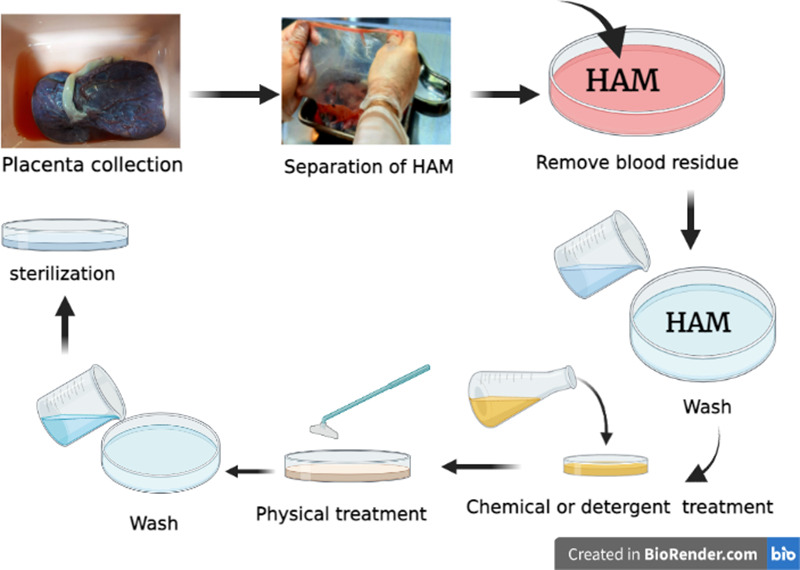 Applications Of Acellular Human Amniotic Membrane In Regenerative ...