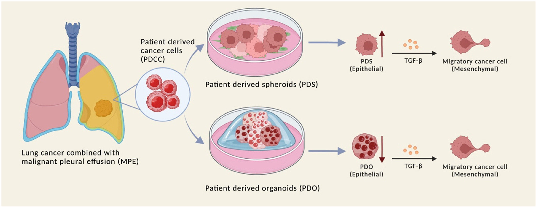 Patient-Derived Spheroids And Patient-Derived Organoids Simulate ...