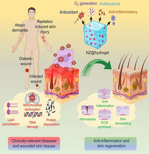 Nanozyme-Engineered Hydrogels for Anti-Inflammation and Skin ...